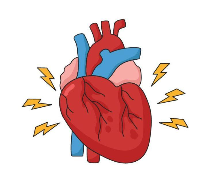 Stroke Detection and Response