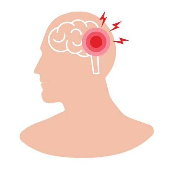 Stroke Detection and Response